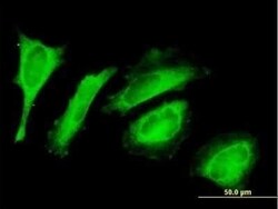 EXD2 Antibody, Novus Biologicals 0.05 mg | Buy Online | Novus Biologicals | Fisher Scientific