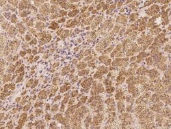 EXOC6 Antibody, Novus Biologicals 100 &mu;g; Unconjugated:Antibodies, Polyclonal