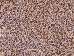 EXOC6 Antibody, Novus Biologicals 100 &mu;g; Unconjugated:Antibodies, Polyclonal