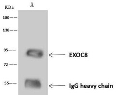 EXOC8 Antibody, Novus Biologicals:Antibodies:Primary Antibodies