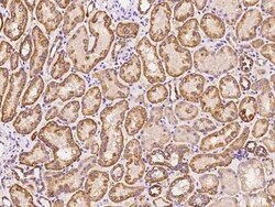 EXOD1 Antibody, Novus Biologicals 50 &mu;g, Unconjugated:Antibodies, Polyclonal