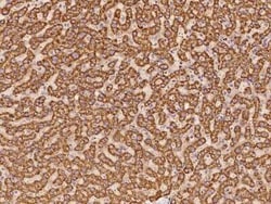 EXOD1 Antibody, Novus Biologicals 50 &mu;g, Unconjugated:Antibodies, Polyclonal