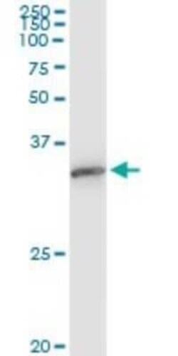 EXOSC3 Antibody (5C3), Novus Biologicals 0.1 mg | Buy Online | Novus Biologicals | Fisher Scientific