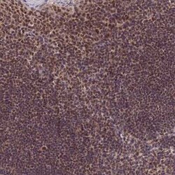 EXOSC3 Antibody, Novus Biologicals:Antibodies:Primary Antibodies