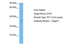 EYA1 Antibody, Novus Biologicals 100 &mu;L; Unconjugated:Antibodies, Polyclonal