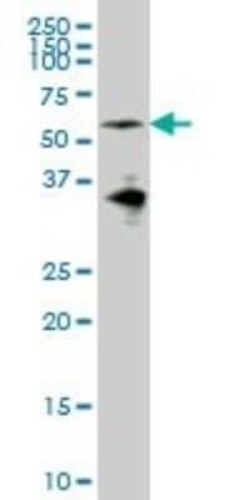 EYA2 Antibody (2F8), Novus Biologicals 0.1 mg | Buy Online | Novus Biologicals | Fisher Scientific