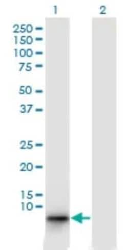 Ebf4 Antibody (4E10), Novus Biologicals 0.1 mg; Unconjugated:Antibodies,