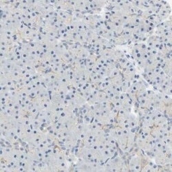 Eg5 Antibody, Novus Biologicals 25 &mu;L; Unconjugated:Anticuerpos