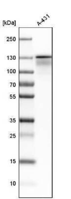 Eg5 Antibody, Novus Biologicals 25 &mu;L; Unconjugated:Anticuerpos