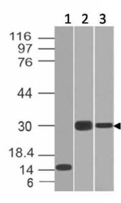Elastase Antibody (CELA3B/1218), Novus Biologicals:Antibodies:Primary Antibodies