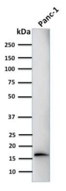 Elastase Antibody (CELA3B/1218), Novus Biologicals:Antibodies:Primary Antibodies