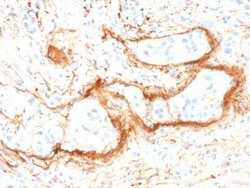 Elastin Antibody (ELN/1981), Novus Biologicals 20 &mu;g; Unconjugated:Antibodies,