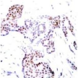 Elk-1, p Ser389 Antibody, Novus Biologicals:Antibodies:Primary Antibodies