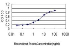 Elongin A Antibody (3E2), Novus Biologicals 0.1 mg | Buy Online | Novus Biologicals | Fisher Scientific