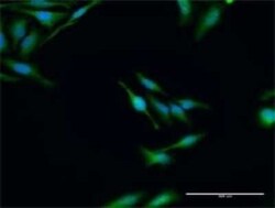 Elp3 Antibody, Novus Biologicals 0.1 mg | Buy Online | Novus Biologicals | Fisher Scientific