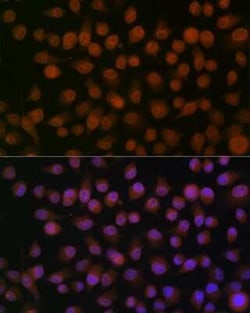 Emerin Rabbit anti-Human, Mouse, Rat, Clone: 10Y5K9, Novus Biologicals