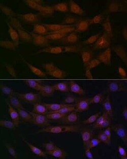 Emerin Rabbit anti-Human, Mouse, Rat, Clone: 10Y5K9, Novus Biologicals