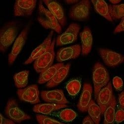 Emerin Antibody (EMD/2167) - Azide and BSA Free, Novus Biologicals 100