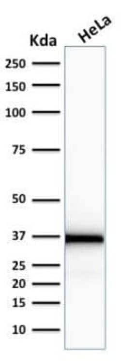 Emerin Antibody (EMD/2167) - Azide and BSA Free, Novus Biologicals 100