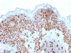Emerin, Mouse anti-Human, Clone: EMD/2167, Novus Biologicals:Antibodies:Primary