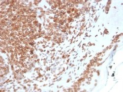 Emerin Antibody (EMD/2168) - Azide and BSA Free, Novus Biologicals 100