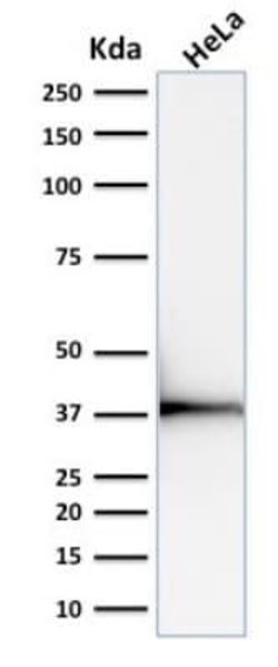 Emerin Mouse anti-Human, Clone: EMD/2168, Novus Biologicals:Antibodies:Primary