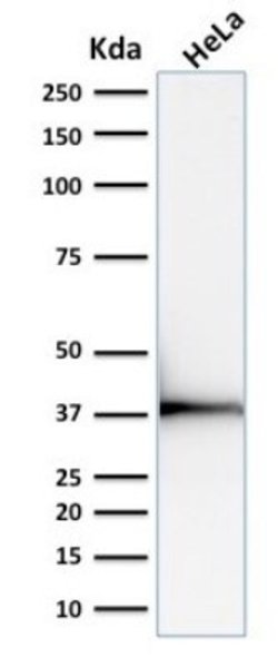 Emerin Antibody (EMD/2168) - Azide and BSA Free, Novus Biologicals 100