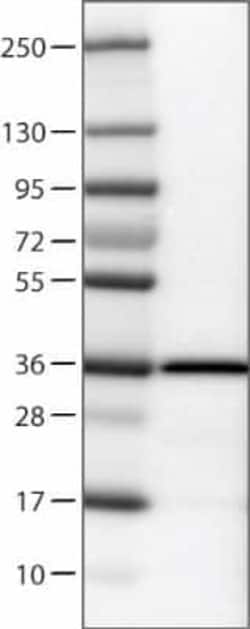 Emerin Antibody (CL0201), Novus Biologicals:Antibodies:Primary Antibodies
