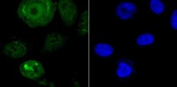 Endo G Antibody (JU31-30), Novus Biologicals 100 &mu;l; Unconjugated:Antibodies,