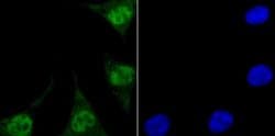 Endo G Antibody (JU31-30), Novus Biologicals 100 &mu;l; Unconjugated:Antibodies,