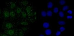 Endo G Antibody (JU31-30), Novus Biologicals 100 &mu;l; Unconjugated:Antibodies,