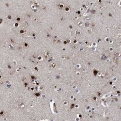Endo G Antibody, Novus Biologicals 25 &mu;L; Unconjugated:Antibodies, Polyclonal