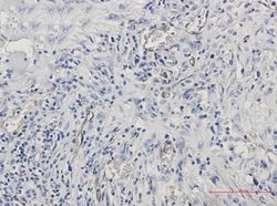 Endoglin/CD105 Rabbit anti-Human, Clone: S05-3H7, Novus Biologicals:Antibodies:Primary