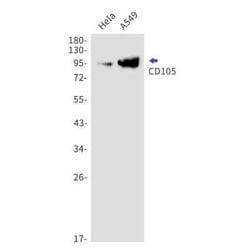 Endoglin/CD105 Rabbit anti-Human, Clone: S05-3H7, Novus Biologicals:Antibodies:Primary