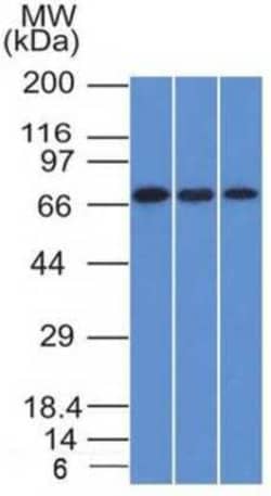 Endoglin/CD105 Antibody (ENG/1326), Novus Biologicals:Antibodies:Primary