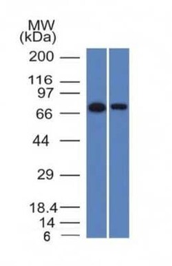 Endoglin/CD105 Antibody (ENG/1327), Novus Biologicals 20&mu;g; Unlabeled:Antibodies,
