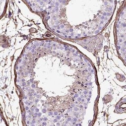 Endoglin/CD105 Antibody, Novus Biologicals 0.1 mL, Unconjugated:Antibodies,