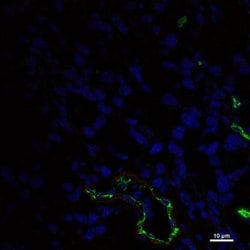 Endoglin/CD105 Antibody (MJ7/18), DyLight 550, Novus Biologicals 0.5 mL;