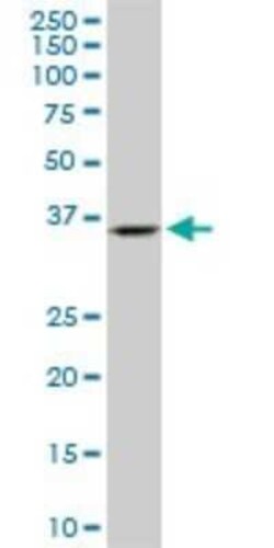 Endophilin A1/SH3GL2 Antibody (2G6), Novus Biologicals 0.1 mg, Unconjugated:Anticuerpos
