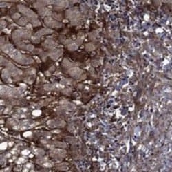 Endostatin Rabbit anti-Human, Polyclonal, Novus Biologicals 25 &mu;g; Unconjugated:Antibodies,