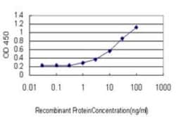 Endothelial Lipase Antibody (1E11), Novus Biologicals 0.1 mg | Buy Online | Novus Biologicals | Fisher Scientific