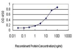 Endothelin-3 Antibody (2A6-2A4), Novus Biologicals 0.1 mg | Buy Online | Novus Biologicals | Fisher Scientific