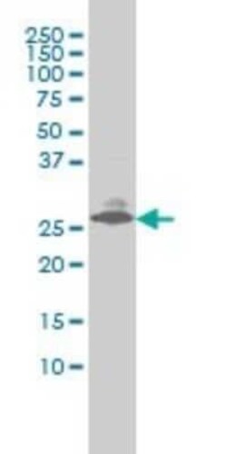 Endothelin-3 Antibody (2A6-2A4), Novus Biologicals 0.1 mg | Buy Online | Novus Biologicals | Fisher Scientific