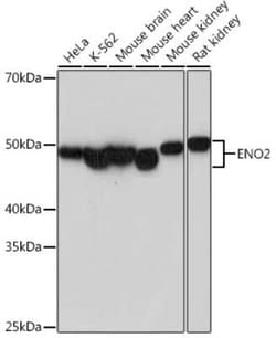 Enolase 2/Neuron-specific Enolase Rabbit anti-Human, Mouse, Rat, Clone: 4D1Z6, Novus Biologicals 20 &mu;g | Buy Online | Novus Biologicals | Fisher Scientific