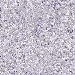 Enteropeptidase/Enterokinase Antibody, Novus Biologicals 100 &mu;g; Unconjugated:Antikörper