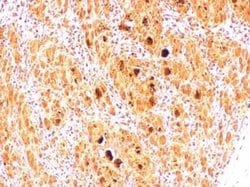 Enterovirus 71 2B Antibody, Novus Biologicals 100 μg; Unconjugated:Antibodies,