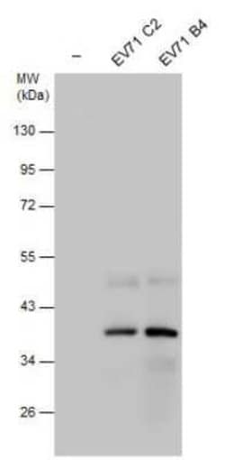 Enterovirus 71 2C Antibody, Novus Biologicals 100 μg; Unconjugated:Antibodies,