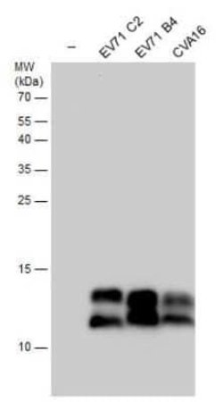 Enterovirus 71 3AB Antibody, Novus Biologicals 100 &mu;g; Unconjugated:Antikörper