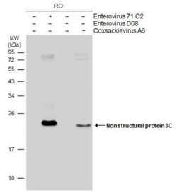 Enterovirus 71 3C Antibody (B3), Novus Biologicals 100 &mu;g | Buy Online | Novus Biologicals | Fisher Scientific
