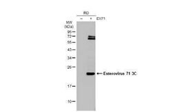 Enterovirus 71 3C Antibody (B3), Novus Biologicals 100 &mu;g | Buy Online | Novus Biologicals | Fisher Scientific